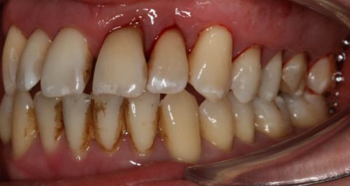 Камень Десен Фото